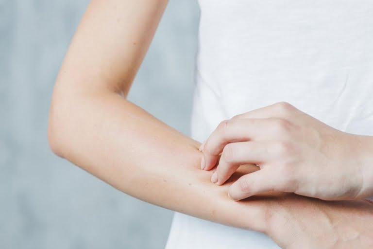 doenças de pele