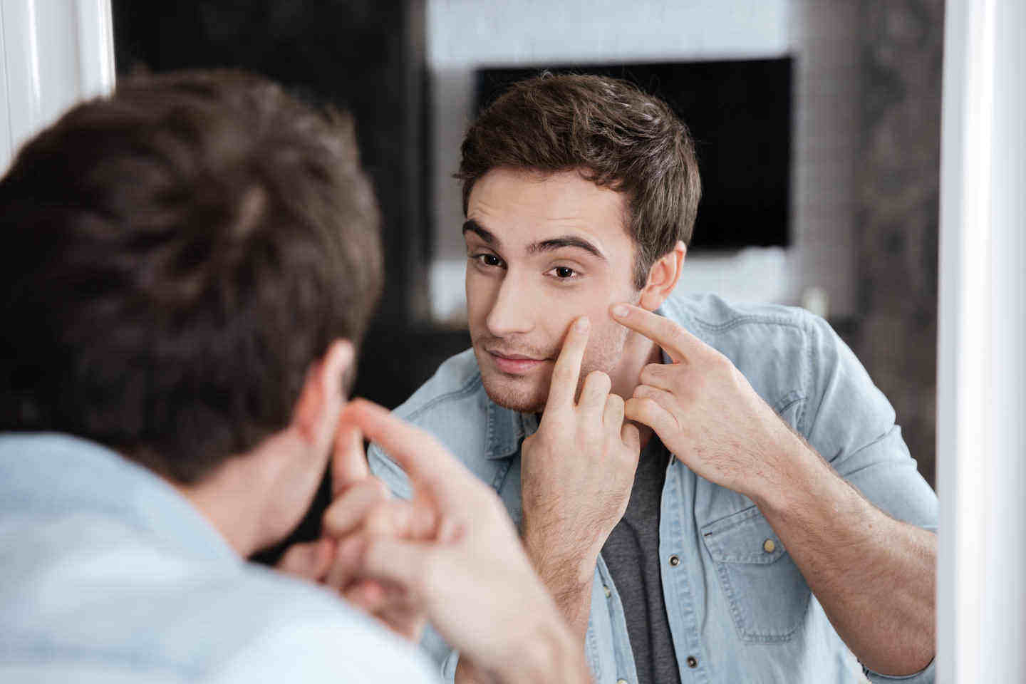 acne-como-tratar-dra-larissa-montanheiro-dermatologista