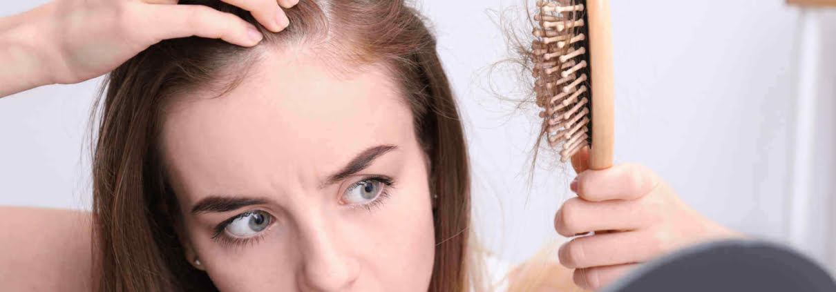 alopecia-fibrosante-frontal-na-testa