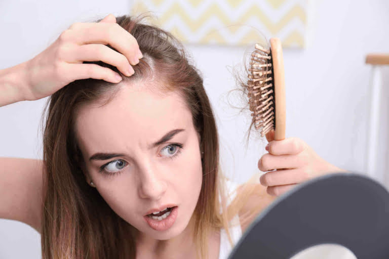 alopecia-fibrosante-frontal-na-testa